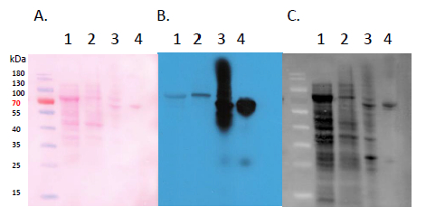 Western blot using anti-GST antibodies